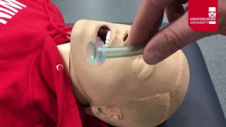 Nasopharyngeal Airway Insertion [upl. by Finbur204]