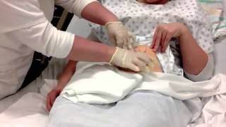 Colostomy Care Teaching Video [upl. by Urian183]