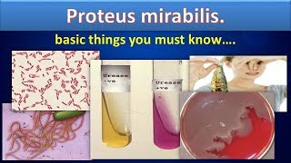 Proteus mirabilissimply clear overviewProteusmirabilisMicrobiologyMLS [upl. by Strohben]