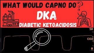 What would CAPNO do DKA [upl. by Pardew]