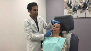 Kybella treatment for submental fat by Dr Patel [upl. by Aihsemaj]