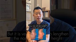 Asian Rhinoplasty  What you need to know before signing up [upl. by Nolahp567]