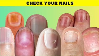 Unlocking the Secrets 9 Things Your Nails Reveal About Your Health [upl. by Erual]