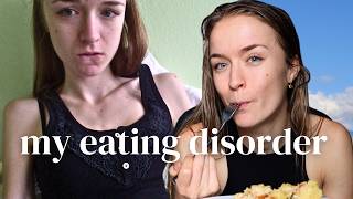 MY 6 YEAR EATING DISORDER RECOVERY STORY  Anorexia and Orthorexia Journey [upl. by Euginimod957]