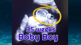 35 weeks baby boy scan  Gender reveal in 8month  Baby Boy  how to tell gender on ultrasoumd  usg [upl. by Vogele]