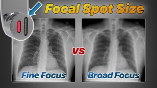 Focal Spot Size Explained Fine vs Broad Focus [upl. by Aicsile941]