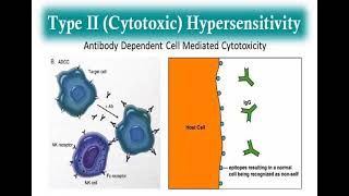 10 Hypersensitivity reactions Type 2  3 and 4 Hypersensitivity reactions شرح بالعربي [upl. by Leah742]