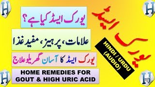 Uric Acid  Gout  Arthritis  Gathiya Symptoms amp Treatment At Home And Foods To Avoid In Hindi Urdu [upl. by Amsirac]