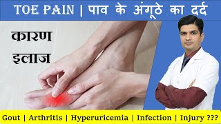 अंगुठे के दर्द का कारण इलाज  Toe pain treatment  Toe pain and swelling [upl. by Htaeh]