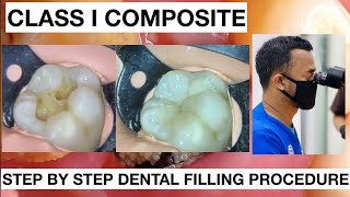 Step by Step Dental Filling Procedure  General Dentist Griya RR [upl. by Gerc]