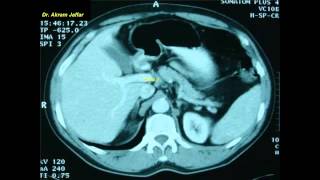 Cross sectional and imaging anatomy of the abdomen [upl. by Mady]