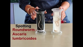 How to do SPOTTING  Biology Practical Class 12  Roundworm  Ascaris lumbricoides [upl. by Hannala]