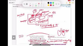 Pneumoconiosis Asbestosis Silicosis Berylliosis coal work Respiratory 42 First Aid USMLE Step1 [upl. by Anehta]