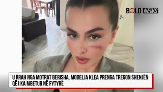 U rrah nga motrat Berisha modelja Klea Prenga tregon shenjën që i ka mbetur në fytyrë [upl. by Aicilaf]