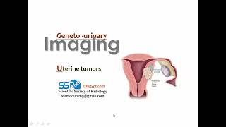 Imaging of uterine masses DRE Prof Mamdouh Mahfouz [upl. by Jesh]