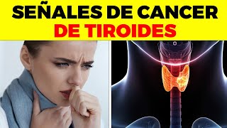 ASI EMPIEZA el Cáncer de Tiroides y nadie te lo dice signos y síntomas de cáncer de tiroides [upl. by Sirrap]