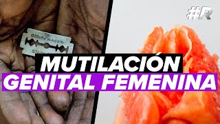 Mutilación Genital Femenina Tolerancia cero a las MGF  Ablación femenina significado [upl. by Lalise914]