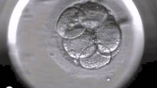 Embryoscope timelapse DanFertdk [upl. by Norred]