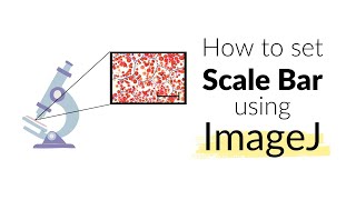 How to set Scale Bar using ImageJ software  Microscope  Imaging howto image [upl. by Pearman]