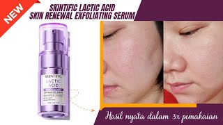 REVIEW SKINTIFIC LACTIC ACID SKIN RENEWAL EXFOLIATING SERUM  AMAN UNTUK PEMULA [upl. by Phylis]