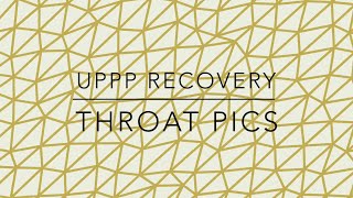 UPPP Patient Recovery Throat Pics [upl. by Happ]