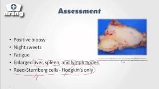 Lymphoma NCLEX® Review  NRSNGacademycom [upl. by Reeves]