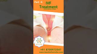 Part 4  IVF Most Effective Treatment Options For Infertility in India ivf podcast ivfsuccess [upl. by Rawlinson]