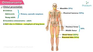 Osteosarcoma 🦴  Orthopedic lectures [upl. by Lairbag468]