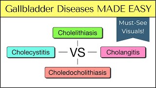 Cholecystitis vs Cholelithiasis vs Cholangitis vs Choledocholithiasis Nursing USMLE [upl. by Ahcmis643]