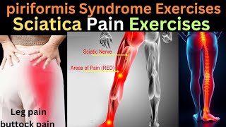 Piriformis Syndrome Relief Simple Stretches to Try  Sciatica Pain Exercise  Buttock Pain [upl. by Anitnemelc]