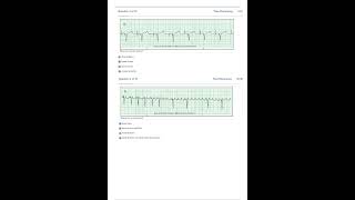 Relias Dysrhythmia Basic Test Answers 2023 Dysrhythmia – Basic A A GRADED 100 VERIFIED [upl. by Brechtel676]