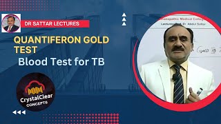 Quantiferon Gold TB Test  A Blood Serum test for TB Diagnosis [upl. by Rida733]