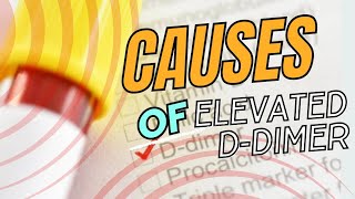 Understanding Ddimer Causes of Elevated Levels and Implications [upl. by Dnalloh]