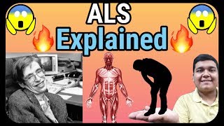 ALS  Amyotrophic Lateral Sclerosis explained  ALS cure [upl. by Atinrev888]