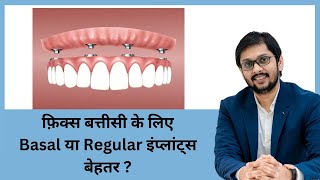 BASAL Implant vs Conventional Implants COMPLETE INFORMATION  हिंदी Dr Ankit [upl. by Enywtna]