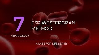 ESR Westergran Method [upl. by Cochrane]