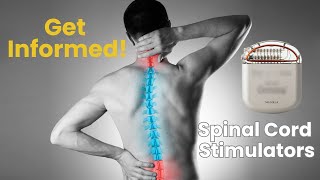 Is a Spinal Cord Stimulator Right for You [upl. by Padegs]