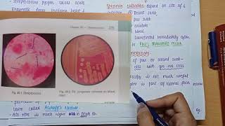 Streptococcus Pyogenes  Morphology  Virulence factors  culture amp lab diagnosis  MICROBIOLOGY [upl. by Gimpel]