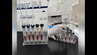 Erythrocyte Sedimentation Rate ESR [upl. by Kcirevam]