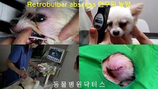 Retrobulbar Abscess Orbital Cellulitis 안구뒤농양 [upl. by Ariane]