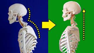 FIX Your Forward Head Posture in 5 Minutes a Day [upl. by Nylram]