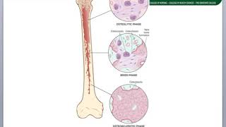 Non Neoplastic Bone Pathology [upl. by Jary]