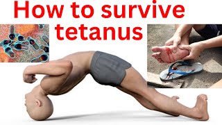 How to survive tetanus  tetanus treatment and cure tetanus sympyoms and prevention [upl. by Acirrej50]