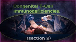 Congenital TCell ImmunodeficienciesDiGeorge Syndrome [upl. by Caras]