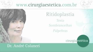 Lifting Facial  Cirurgia Plástica da Face Como é Dr Andre Colaneri explica [upl. by Behka]