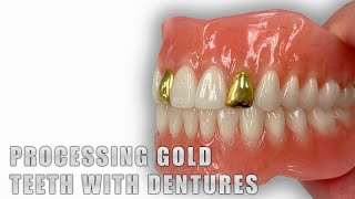 Processing Gold Teeth with Dentures [upl. by Alejandro866]