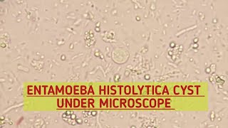 Entamoeba Histolytica EHcyst under microscopeStool MicroscopyStool Parasites under microscope [upl. by Ainekahs]