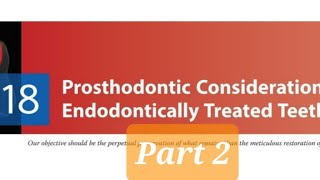 Prosthodontic Considerations in RCT Treated Teeth 2Factors affecting post selectionTypes of Posts [upl. by Lynch]