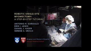 Robotic Singlesite Myomectomy Video  Brigham and Women’s Hospital [upl. by Kenay109]