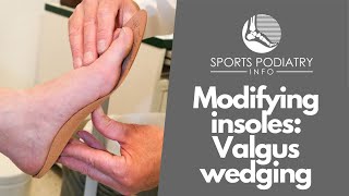 Chairside Modifications in Podiatry Lateral  Valgus Wedging [upl. by Bakeman]